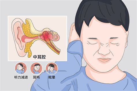 右耳一直耳鸣|持续性的耳鸣24小时不间断